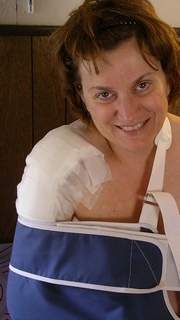 Lorraine Ash — one day after open rotator cuff surgery.